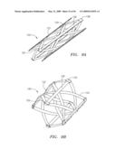 Prosthetic Heart Valves, Support Structures and Systems and Methods for Implanting the Same diagram and image