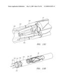 Prosthetic Heart Valves, Support Structures and Systems and Methods for Implanting the Same diagram and image