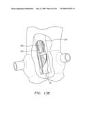 Prosthetic Heart Valves, Support Structures and Systems and Methods for Implanting the Same diagram and image