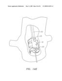 Prosthetic Heart Valves, Support Structures and Systems and Methods for Implanting the Same diagram and image