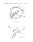 Prosthetic Heart Valves, Support Structures and Systems and Methods for Implanting the Same diagram and image