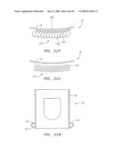 Prosthetic Heart Valves, Support Structures and Systems and Methods for Implanting the Same diagram and image