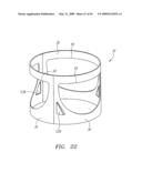 Prosthetic Heart Valves, Support Structures and Systems and Methods for Implanting the Same diagram and image