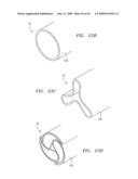 Prosthetic Heart Valves, Support Structures and Systems and Methods for Implanting the Same diagram and image