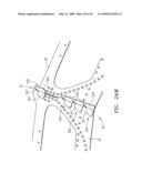 Prosthetic Heart Valves, Support Structures and Systems and Methods for Implanting the Same diagram and image