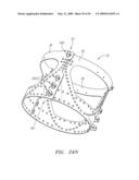 Prosthetic Heart Valves, Support Structures and Systems and Methods for Implanting the Same diagram and image