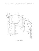 Prosthetic Heart Valves, Support Structures and Systems and Methods for Implanting the Same diagram and image