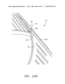 Prosthetic Heart Valves, Support Structures and Systems and Methods for Implanting the Same diagram and image