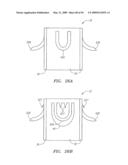 Prosthetic Heart Valves, Support Structures and Systems and Methods for Implanting the Same diagram and image