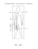 Prosthetic Heart Valves, Support Structures and Systems and Methods for Implanting the Same diagram and image