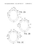 Valve Frame diagram and image