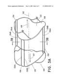 Valve Frame diagram and image