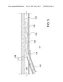 Ocular Implant Delivery System and Method diagram and image