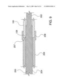 Ocular Implant Delivery System and Method diagram and image