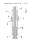 Ocular Implant Delivery System and Method diagram and image