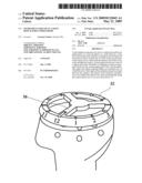 INSTRUMENT FOR USE IN A JOINT REPLACEMENT PROCEDURE diagram and image