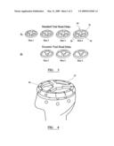 INSTRUMENT FOR USE IN A JOINT REPLACEMENT PROCEDURE diagram and image