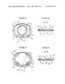 Intervertebral Disc Prosthesis diagram and image