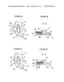 Intervertebral Disc Prosthesis diagram and image