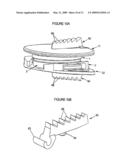 Intervertebral Disc Prosthesis diagram and image