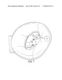 LARYNGEAL MASK AIRWAY DEVICE diagram and image