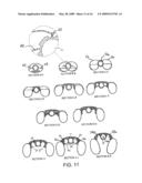 LARYNGEAL MASK AIRWAY DEVICE diagram and image