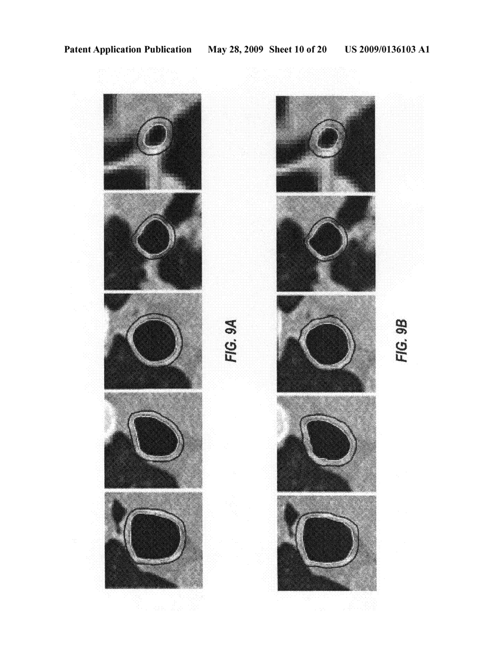 System and methods for image segmentation in N-dimensional space - diagram, schematic, and image 11