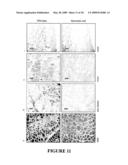 Use of Myostatin (GDF-8) Antagonists for Treatment of Sarcopenia (Age-Related Muscle-Wasting) diagram and image