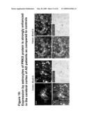 Diagnostic and therapeutic target PRKX proteins for neurodegenerative diseases diagram and image