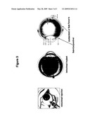 Tetracyclines for Treating Ocular Diseases and Disorders diagram and image