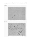 Methods of diagnosing, preventing and treating infection with Hepatitis C virus diagram and image