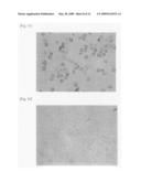 Methods of diagnosing, preventing and treating infection with Hepatitis C virus diagram and image