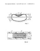 Methods, Devices, And Compositions For Lysis Of Occlusive Blood Clots While Sparing Wound Sealing Clots diagram and image