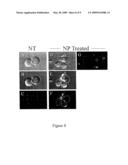 PREFERENTIAL KILLING OF CANCER CELLS AND ACTIVATED HUMAN T CELLS USING ZnO NANOPARTICLES diagram and image