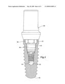 DENTAL IMPLANT SYSTEM diagram and image