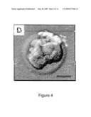 METHODS FOR MAKING AND USING REPROGRAMMED HUMAN SOMATIC CELL NUCLEI AND AUTOLOGOUS AND ISOGENIC HUMAN STEM CELLS diagram and image