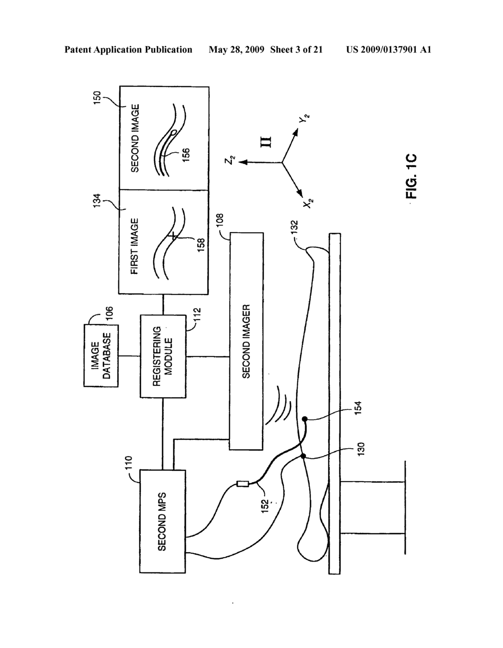 METHOD AND SYSTEM FOR REGISTERIING A MEDICAL SITUATION ASSOCIATED WITH A FIRST COORDINATE SYSTEM, IN A SECOND COORDINATE SYSTEM USING AN MPS SYSTEM - diagram, schematic, and image 04