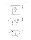 METHOD AND SYSTEM FOR REGISTERIING A MEDICAL SITUATION ASSOCIATED WITH A FIRST COORDINATE SYSTEM, IN A SECOND COORDINATE SYSTEM USING AN MPS SYSTEM diagram and image