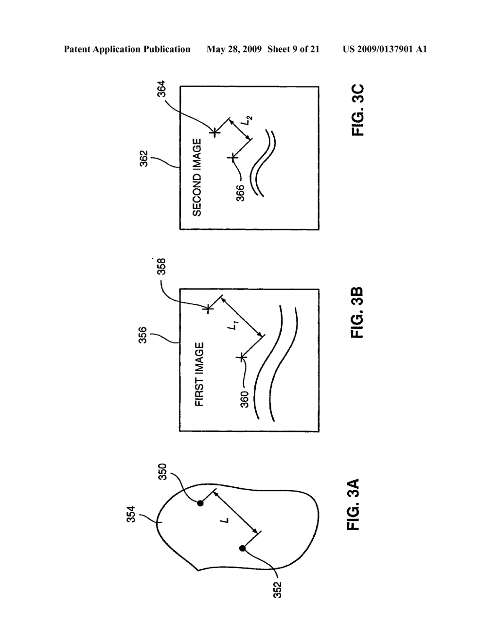 METHOD AND SYSTEM FOR REGISTERIING A MEDICAL SITUATION ASSOCIATED WITH A FIRST COORDINATE SYSTEM, IN A SECOND COORDINATE SYSTEM USING AN MPS SYSTEM - diagram, schematic, and image 10