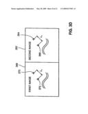 METHOD AND SYSTEM FOR REGISTERIING A MEDICAL SITUATION ASSOCIATED WITH A FIRST COORDINATE SYSTEM, IN A SECOND COORDINATE SYSTEM USING AN MPS SYSTEM diagram and image