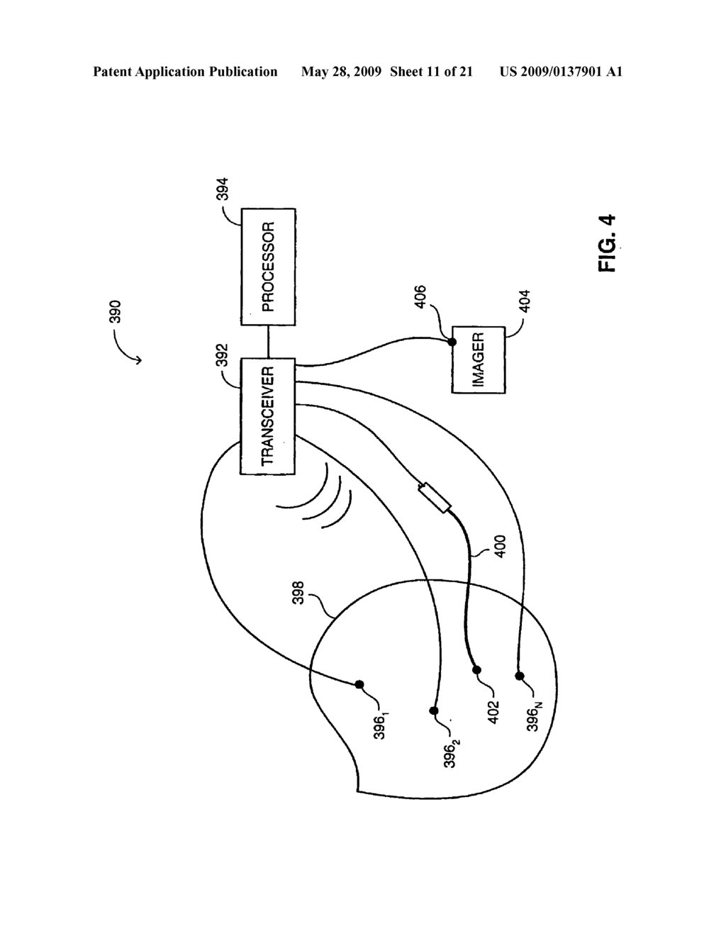 METHOD AND SYSTEM FOR REGISTERIING A MEDICAL SITUATION ASSOCIATED WITH A FIRST COORDINATE SYSTEM, IN A SECOND COORDINATE SYSTEM USING AN MPS SYSTEM - diagram, schematic, and image 12