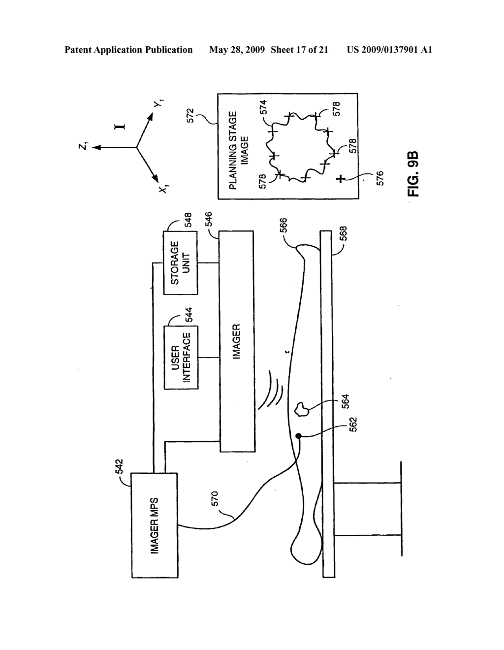 METHOD AND SYSTEM FOR REGISTERIING A MEDICAL SITUATION ASSOCIATED WITH A FIRST COORDINATE SYSTEM, IN A SECOND COORDINATE SYSTEM USING AN MPS SYSTEM - diagram, schematic, and image 18