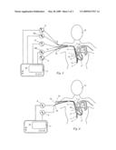 Central venous catheter assembly for measuring physiological data for cardiac output determination and method of determining cardiac output diagram and image