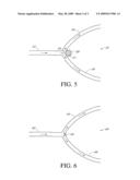 METHODS OF TREATING A BLOOD VESSEL diagram and image