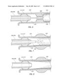 Guiding Catheter with Resiliently Compressible Occluder diagram and image