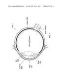 Methods and Apparatus for Laser Treatment of the Crystalline Lens diagram and image