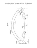 Methods and Apparatus for Laser Treatment of the Crystalline Lens diagram and image