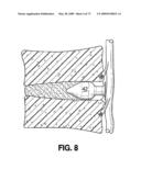 SPINAL IMPLANTS AND METHODS diagram and image