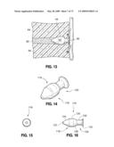 SPINAL IMPLANTS AND METHODS diagram and image