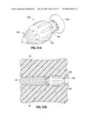 SPINAL IMPLANTS AND METHODS diagram and image